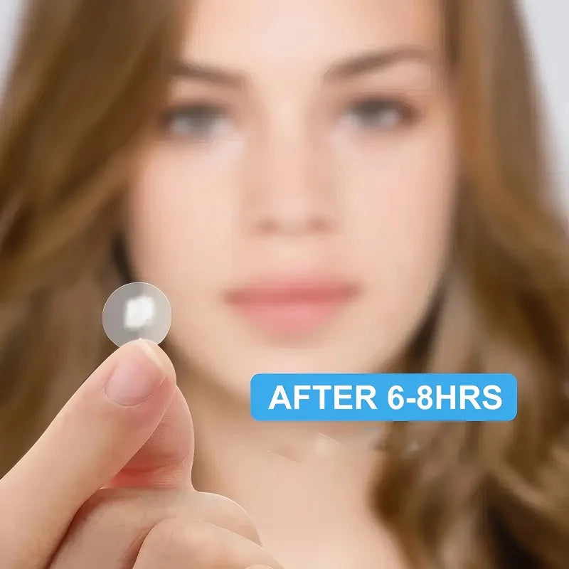 180/360 pieces of transparent, skin tone water-based gel acne patches, suitable for covering acne and pimples